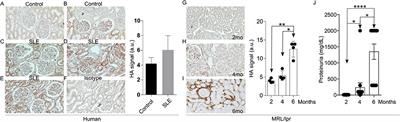 Hyaluronic Acid Synthesis Contributes to Tissue Damage in Systemic Lupus Erythematosus